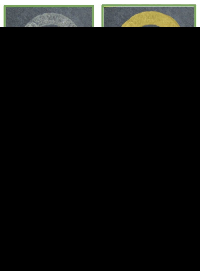 Battery Laser Welding Position — ví dụ kiểm tra lỗi ngành Energy Storage