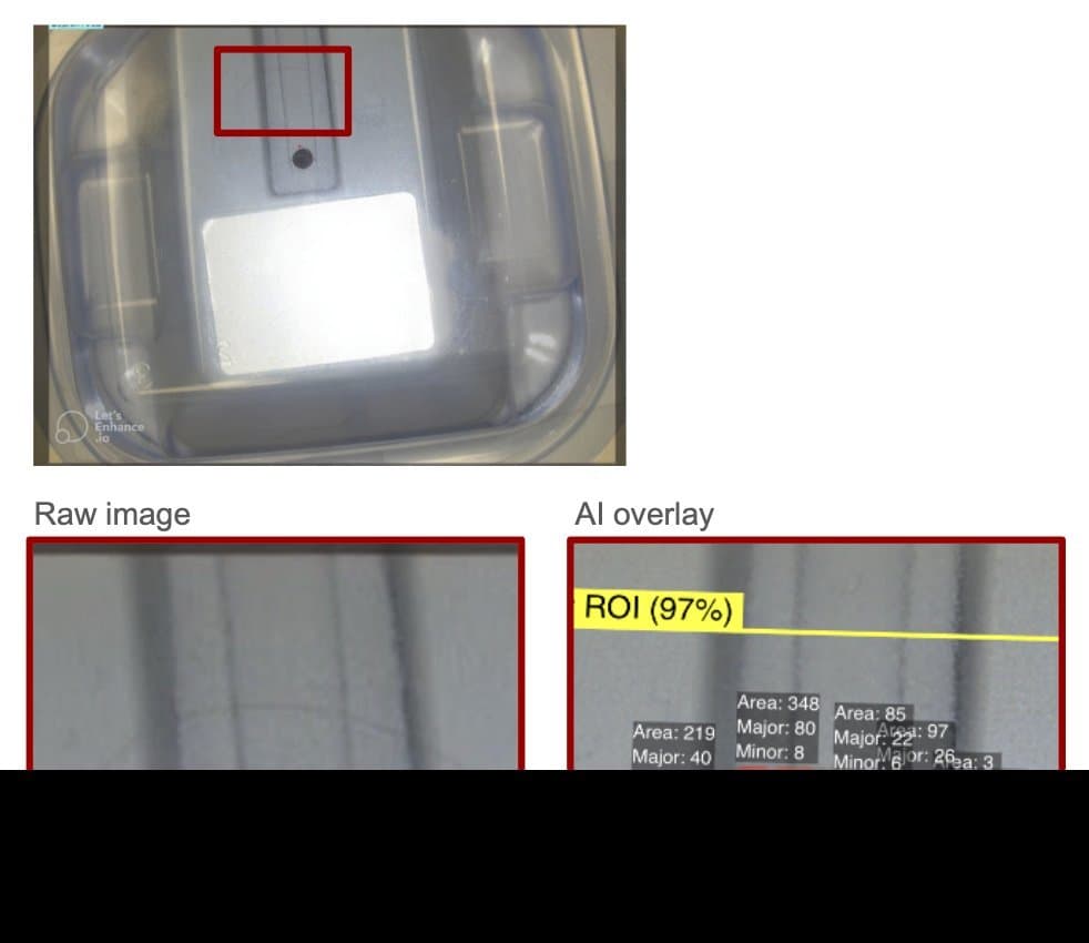 Medical Part Contaminant Scan — ví dụ kiểm tra lỗi ngành Medical